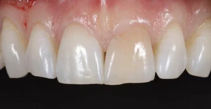 Before Image