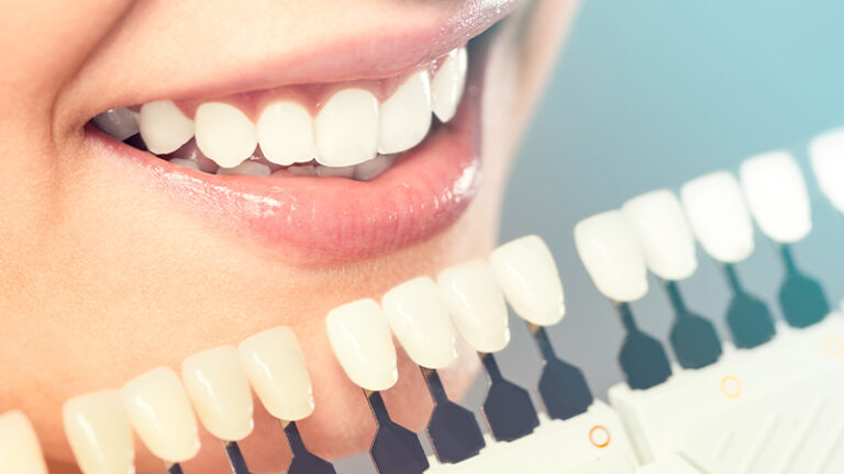 Cosmetic Dentistry