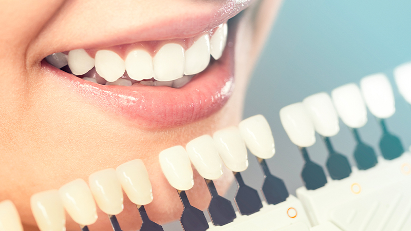 Tracy’s Secret to a Confident Smile: How Cosmetic Dentistry Can Boost More Than Just Your Appearance
